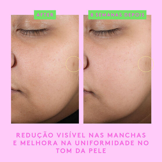 B-Goldi S&eacute;rum  Bright Drops